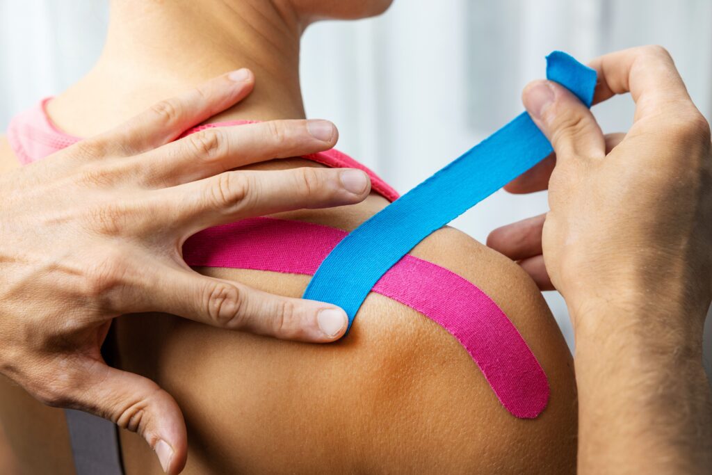 An image of a physiotherapist taping a patient's shoulder with Kinesio Tape.