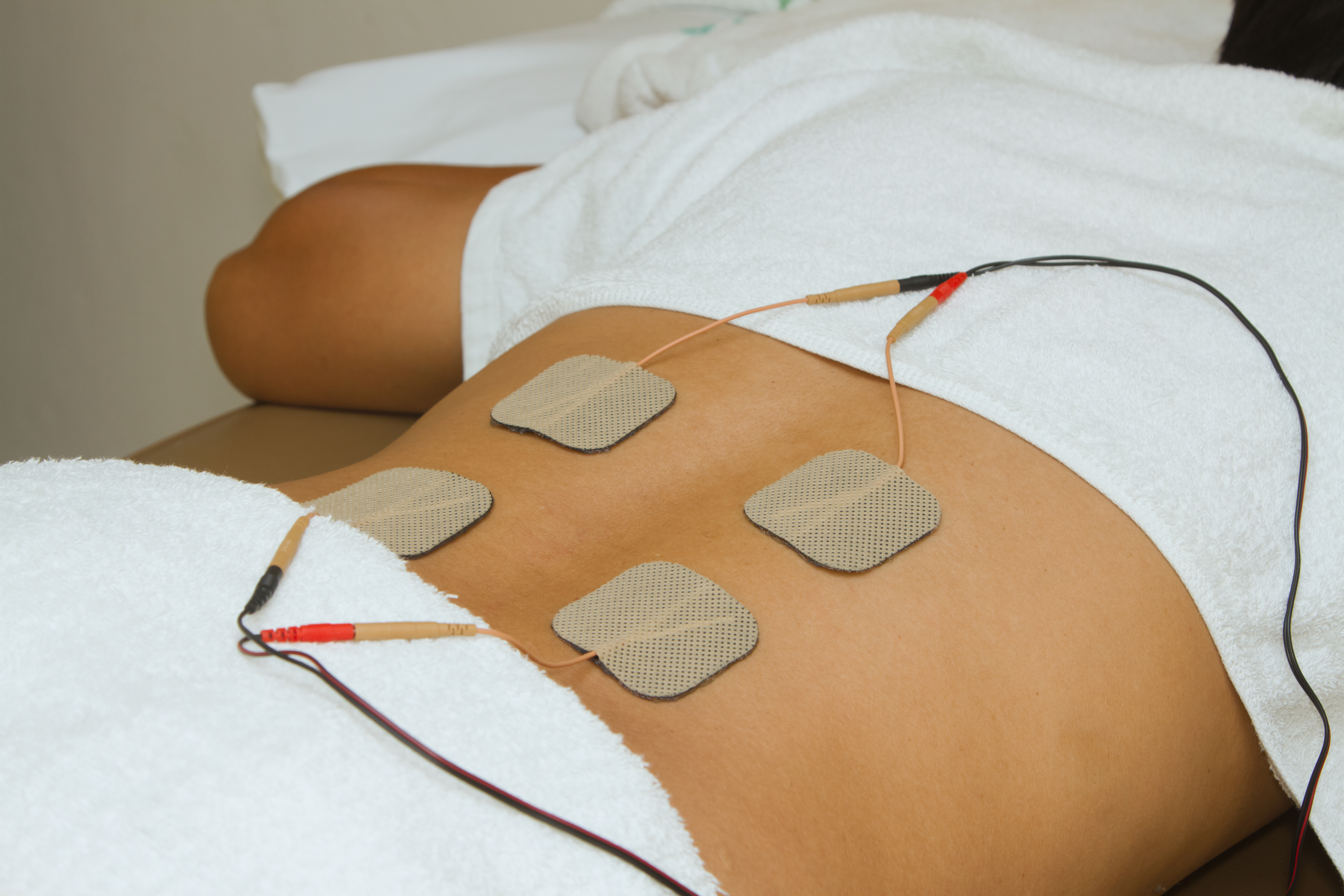 An image of a patient laying on their stomach with electrical stimulation pads attached to their back